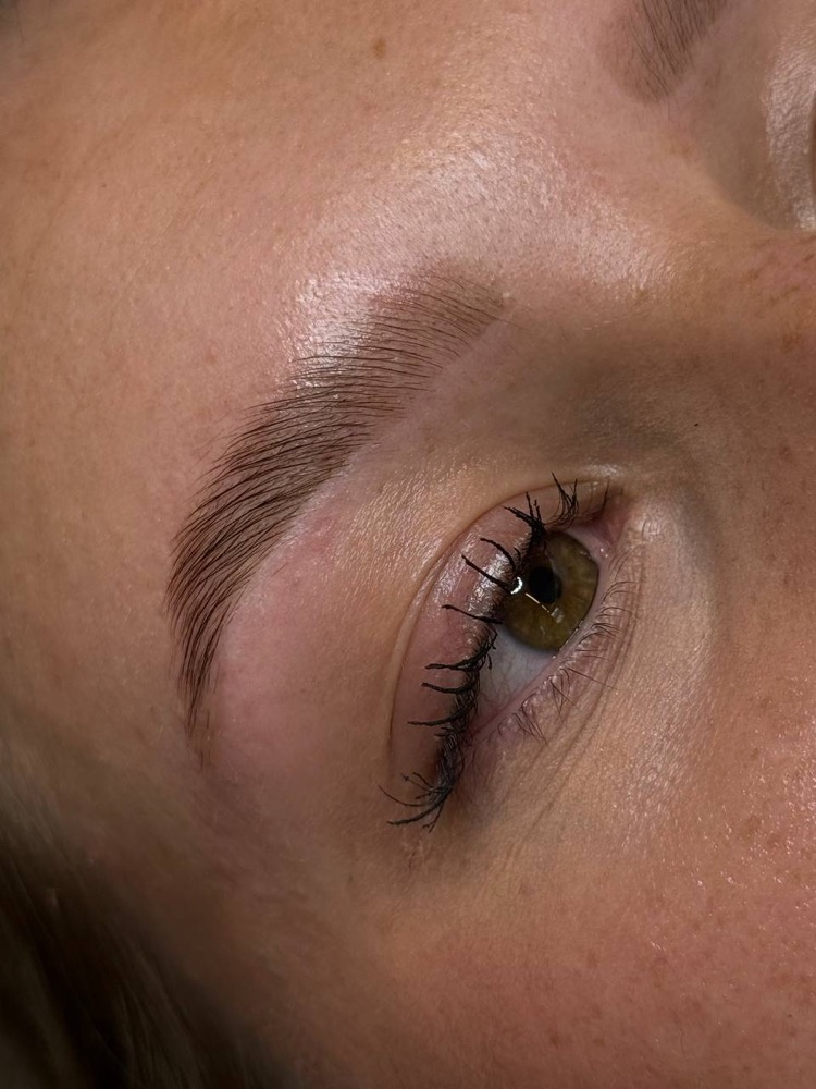 Browlifting-Ergebnis von Jana