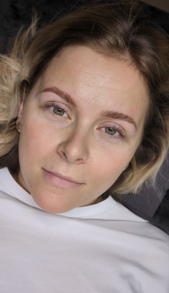 Browlifting-Ergebnis von Lisa